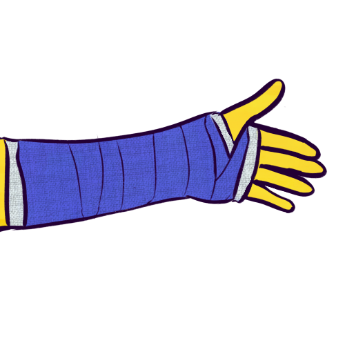 A drawing of a yellow human forearm with a blue plaster cast wrapped around it to immobilize the wrist.